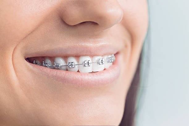 Dental Inlays and Onlays in Mokena, IL